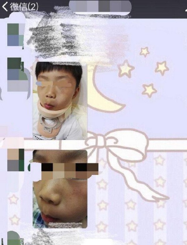 Bức xúc vì kiểu giáo dục ‘đấm bốc’ của giáo viên mầm non ảnh 1