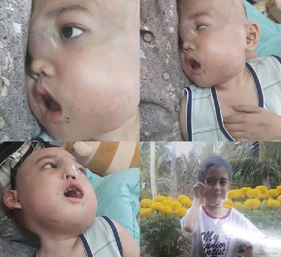 Sau cú ngã, bi kịch ập đến với bé trai khôi ngô, tuấn tú ảnh 1