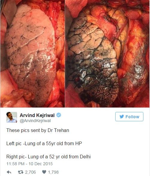 Báo động về tình trạng ô nhiễm không khí tại Ấn Độ ảnh 2