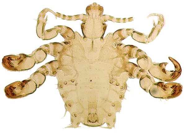 Rùng mình trước sự tái xuất của rận mu ảnh 2