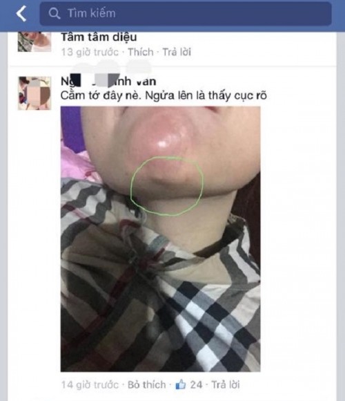 Chuộng thẩm mỹ nhiều thiếu nữ ở Hà Nội biến dạng sau một đêm ảnh 20