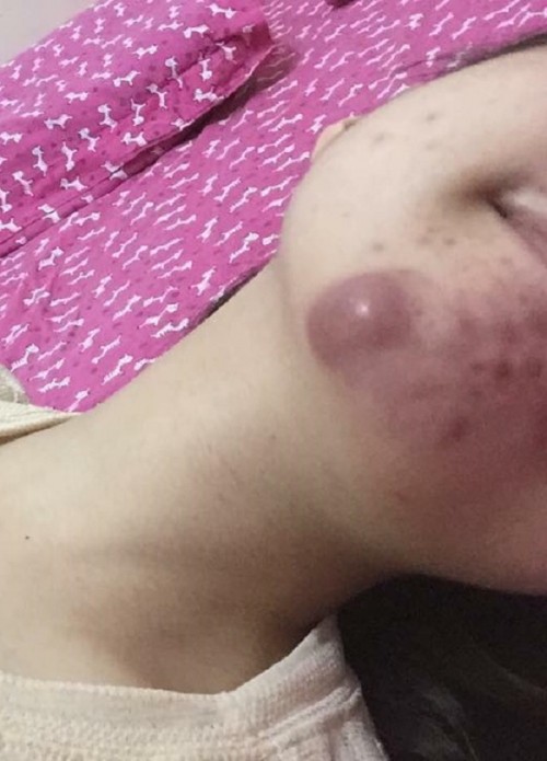 Chuộng thẩm mỹ nhiều thiếu nữ ở Hà Nội biến dạng sau một đêm ảnh 19