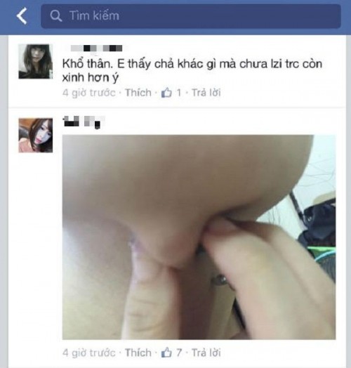 Chuộng thẩm mỹ nhiều thiếu nữ ở Hà Nội biến dạng sau một đêm ảnh 18