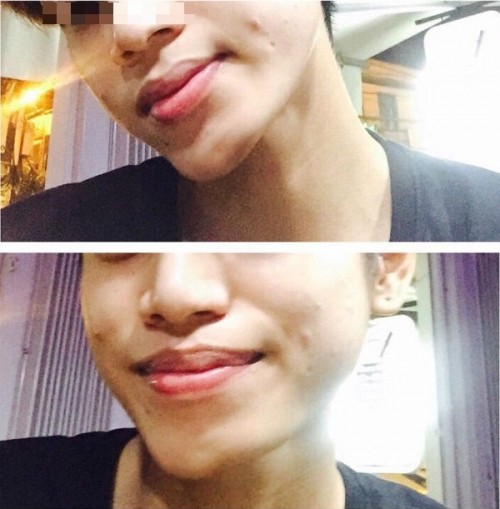 Chuộng thẩm mỹ nhiều thiếu nữ ở Hà Nội biến dạng sau một đêm ảnh 15