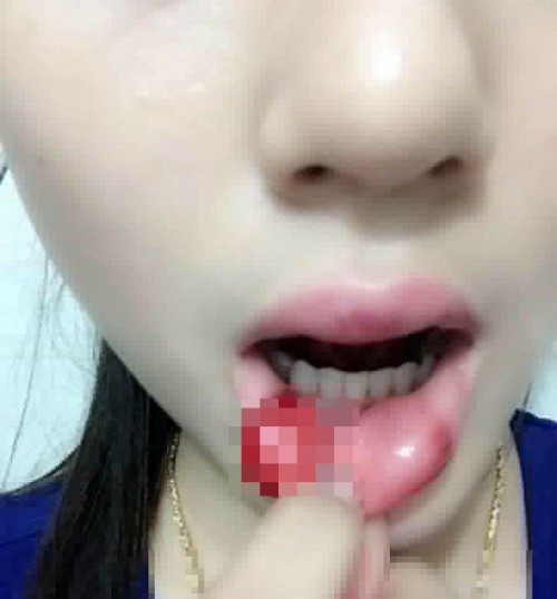 Chuộng thẩm mỹ nhiều thiếu nữ ở Hà Nội biến dạng sau một đêm ảnh 11