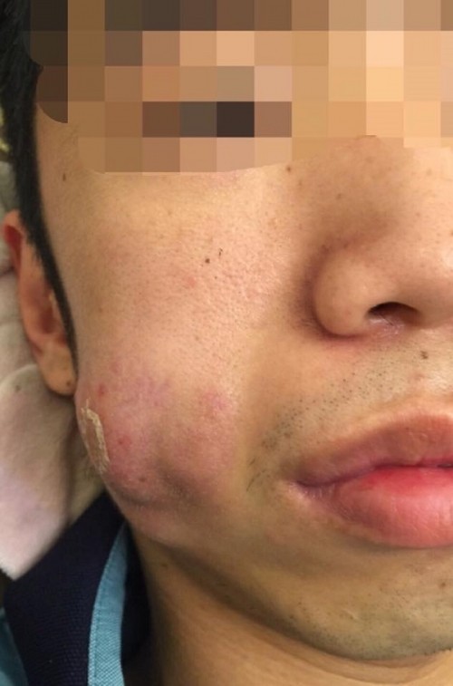 Chuộng thẩm mỹ nhiều thiếu nữ ở Hà Nội biến dạng sau một đêm ảnh 12