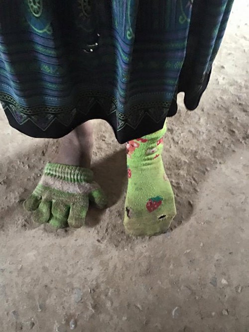 Ảnh bé gái dùng găng tay làm tất chân khiến cộng đồng mạng nhói lòng