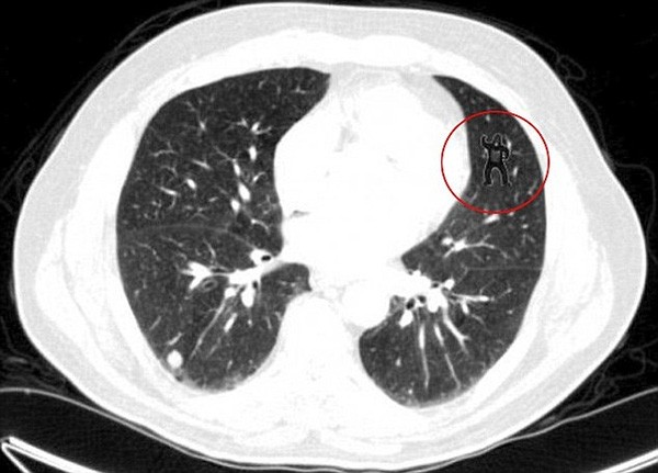 3 giả thiết trong sự cố đọc nhầm tên Hoa hậu Hoàn vũ 2015 ảnh 3