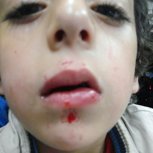 Chuột khổng lồ tấn công bé trai khi đang ngủ ảnh 1