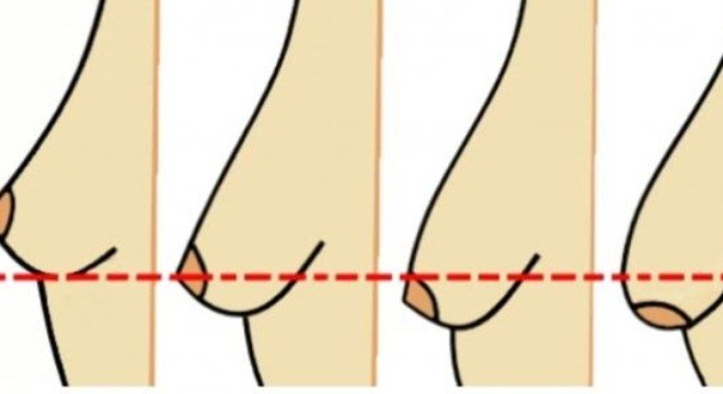 Bí kíp để ngực chảy xệ "no tròn" như ngực đôi mươi ảnh 1