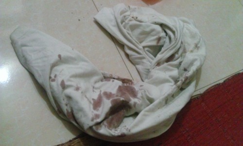 Tin mới nhất vụ trưởng thôn bị côn đồ hành hung vì tố cáo sai phạm ảnh 2