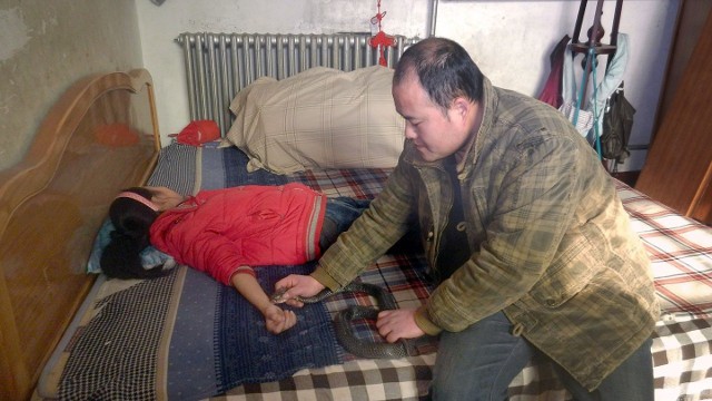 Hãi hùng cha cho rắn hổ mang cực độc cắn tay con gái để chữa bệnh ảnh 1