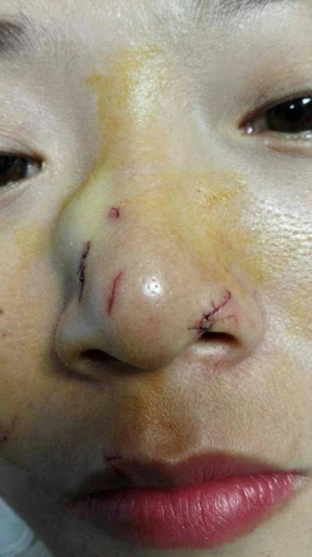 Kinh hoàng khoảnh khắc cô gái bị con trăn cắn phập vào mũi [VIDEO] ảnh 1