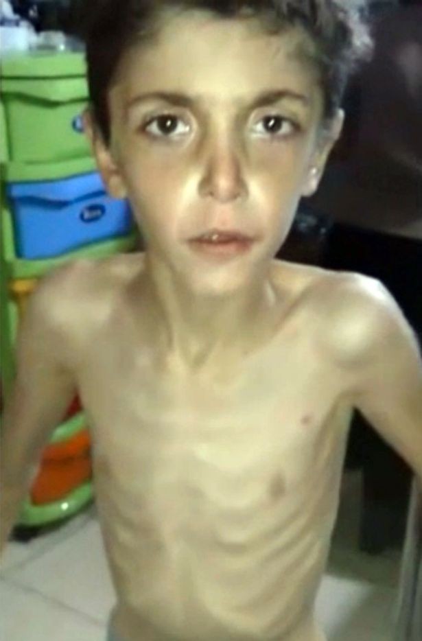 Nạn đói biến người dân Syria thành “những bộ xương khô” ảnh 2