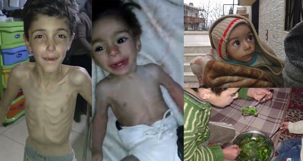 Nạn đói biến người dân Syria thành “những bộ xương khô” ảnh 3