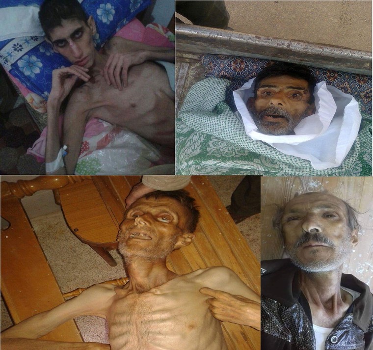 Nạn đói biến người dân Syria thành “những bộ xương khô” ảnh 4