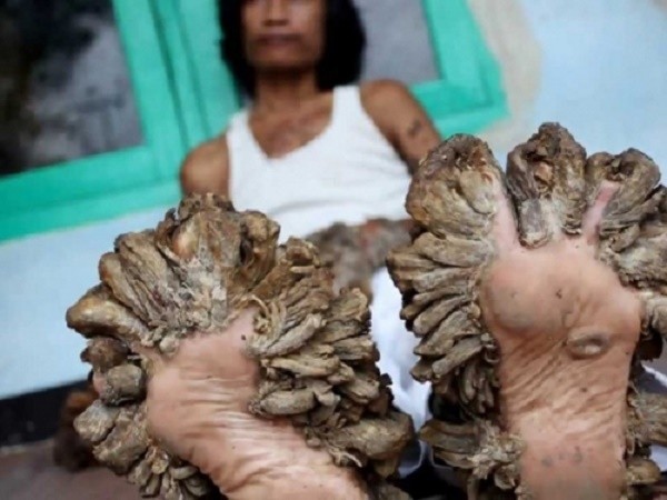 10 chứng bệnh kỳ quái nhất mà con người đang mắc ảnh 1