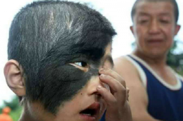 10 chứng bệnh kỳ quái nhất mà con người đang mắc ảnh 2