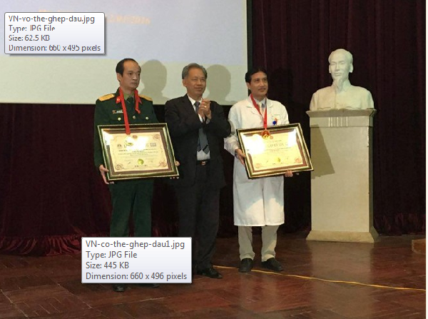 Việt Nam có thể tiến hành ghép đầu người ảnh 1