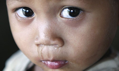 20 sự thật bạn chưa từng biết về đôi mắt ảnh 3