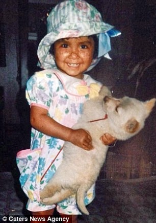 Trường hợp được cho là 'ma cà rồng' đầu tiên trên thế giới ảnh 3