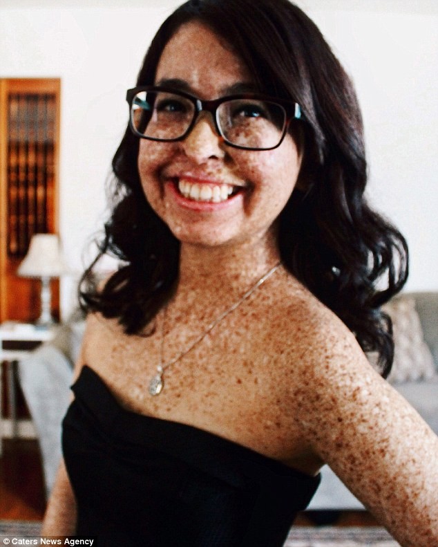 Trường hợp được cho là 'ma cà rồng' đầu tiên trên thế giới ảnh 5