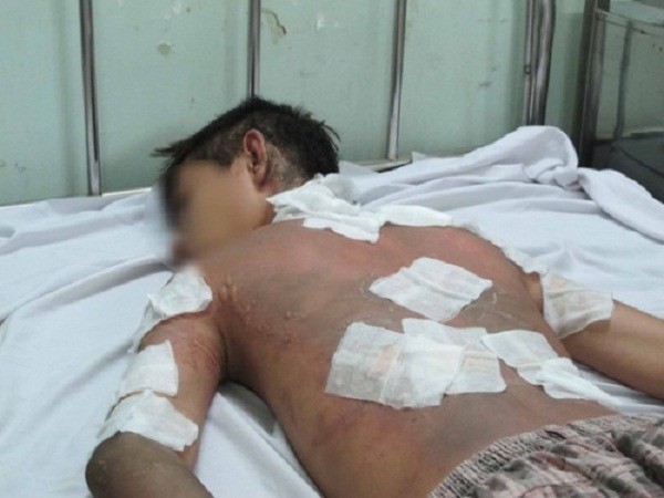 TP HCM: Truy nã thiếu niên tạt xăng đốt học sinh trước cổng trường ảnh 2