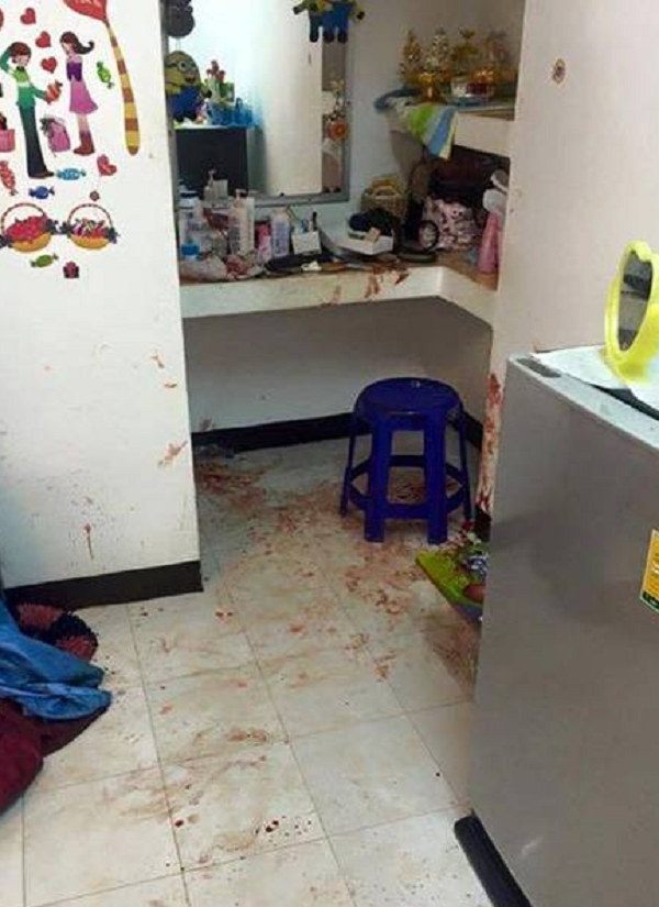 Vì bát cẩn cô gái bị trộm lẻn vào đánh 'nát' khuôn mặt ảnh 2