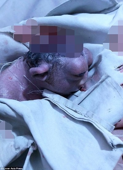 Hoảng hồn 'em bé ngoài hành tinh' sinh ra tại Ấn Độ ảnh 2