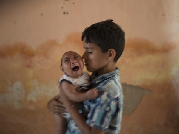 Kinh hãi virus gây tật đầu nhỏ ở trẻ sơ sinh đang lan rộng ảnh 1