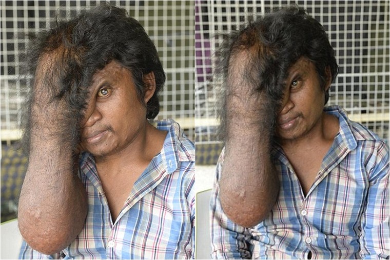 Bi kịch của người đàn ông có phần đầu rớt tận xuống ngực ảnh 1