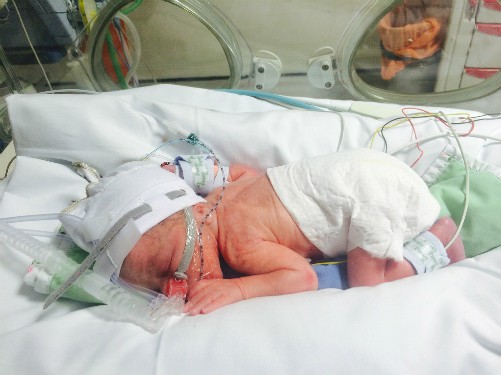 Phát hoảng vì sản phụ mổ đẻ nhưng không thấy em bé ảnh 2