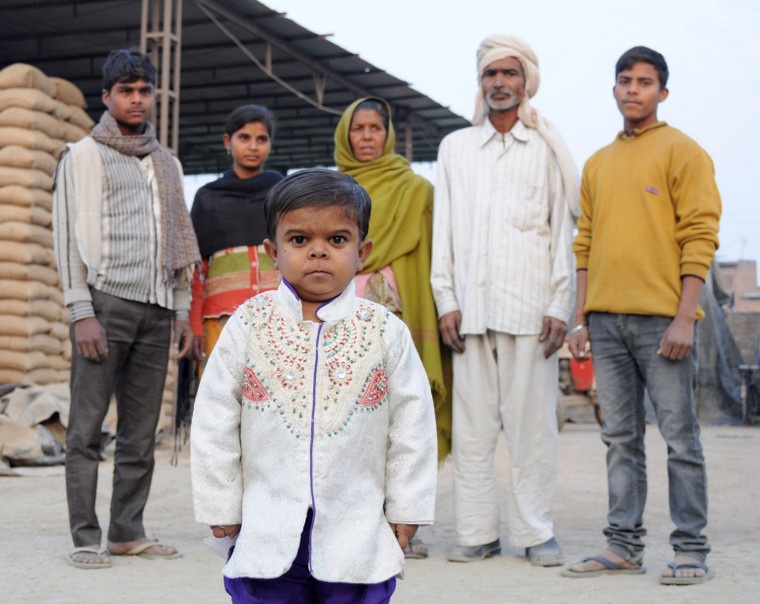 Chuyện lạ: Thiếu niên 15 tuổi chỉ cao 81 cm ảnh 1