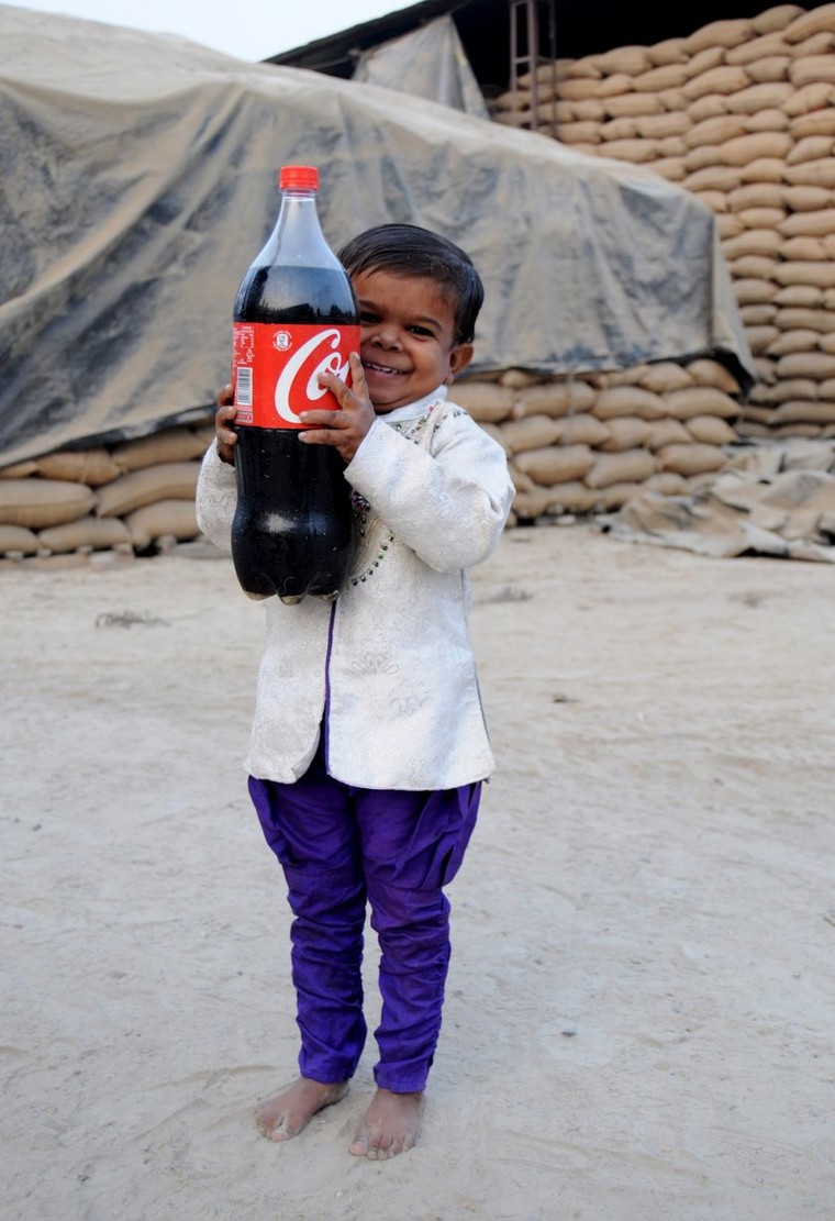 Chuyện lạ: Thiếu niên 15 tuổi chỉ cao 81 cm ảnh 3