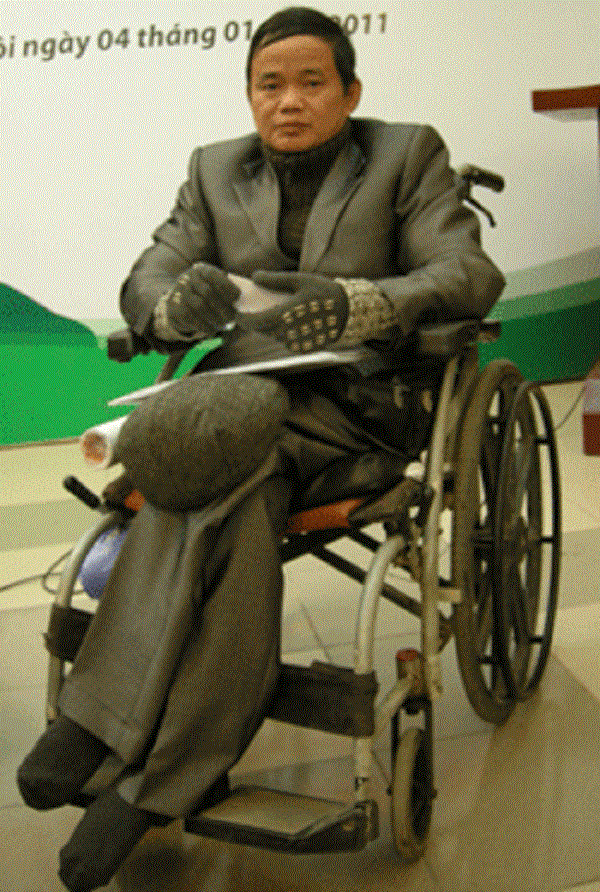 ‘Đại ca bến Khuể’ 2 chân cụt sát đùi, và mối tình như mơ ảnh 1