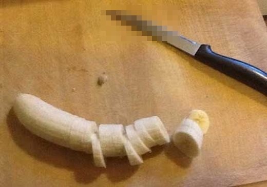 Sốc: Chàng trai cắt bỏ “của quý” sau khi bị từ chối lời yêu ảnh 2