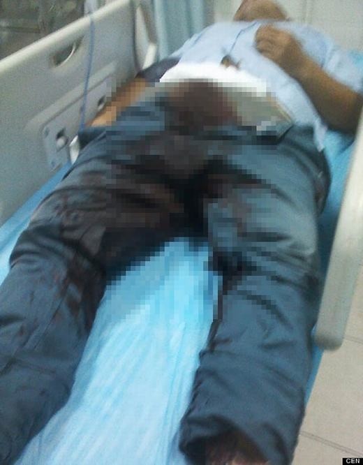 Sốc: Chàng trai cắt bỏ “của quý” sau khi bị từ chối lời yêu ảnh 3