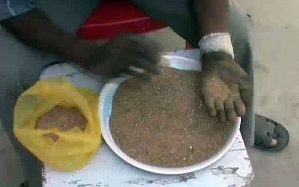 Kì lạ người đàn ông có sở thích ăn cát sỏi suốt 25 năm ảnh 2