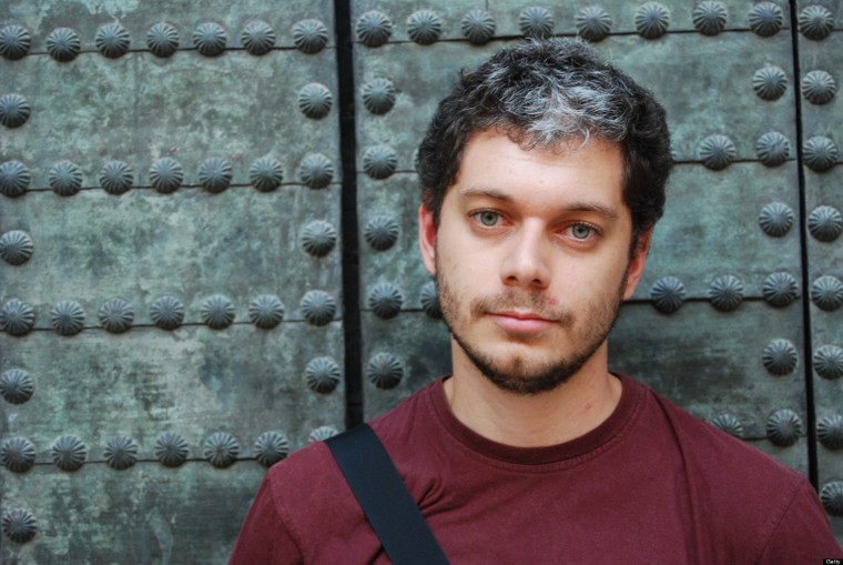 Có hay không việc tóc bạc trắng chỉ sau một đêm? ảnh 1