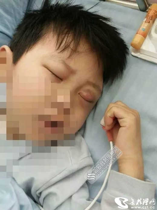 Cậu bé bị mù sau khi bị cô giáo tát liên tiếp vào mặt ảnh 1