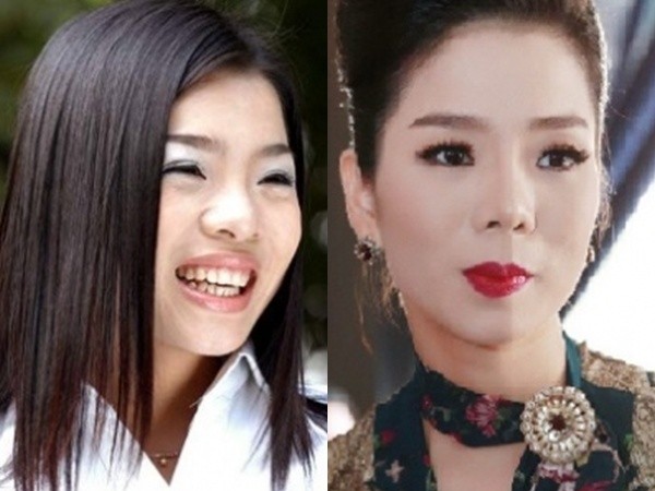 Sau 'dao kéo', Lệ Quyên tự nhận khuôn mặt của mình đã hài hòa ảnh 1