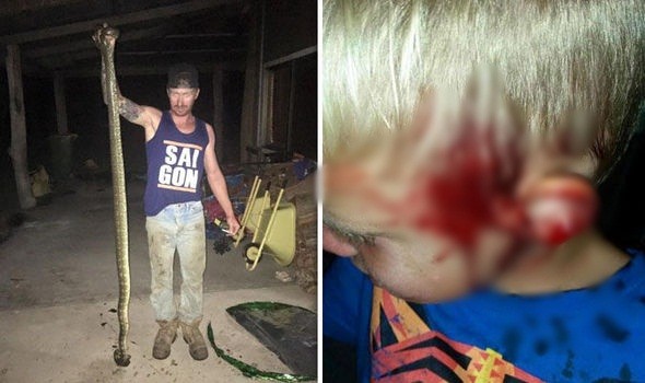 Kinh hãi phát hiện trăn 3 mét cắn cậu bé 6 tuổi khi đang ngủ ảnh 1