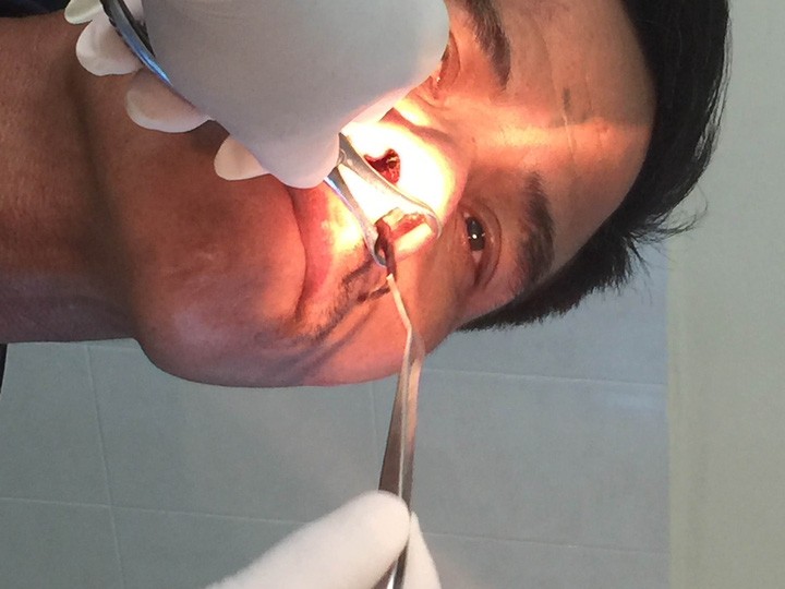 Rùng mình đỉa 'làm tổ' trong hốc mũi người đàn ông ở Ninh Thuận ảnh 1