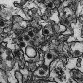  Những điều cần biết về virus 'ăn não' Zika đang lan ra toàn cầu ảnh 1