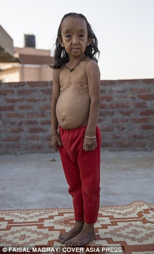 Nỗi tuyệt vọng của hai chị em bỗng dưng hóa thành người già ảnh 3