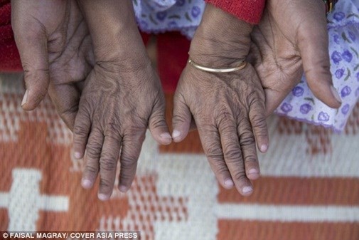 Nỗi tuyệt vọng của hai chị em bỗng dưng hóa thành người già ảnh 6