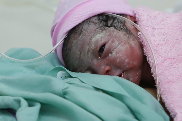 Chào đón công dân nhí đầu tiên của năm Bính Thân ảnh 3