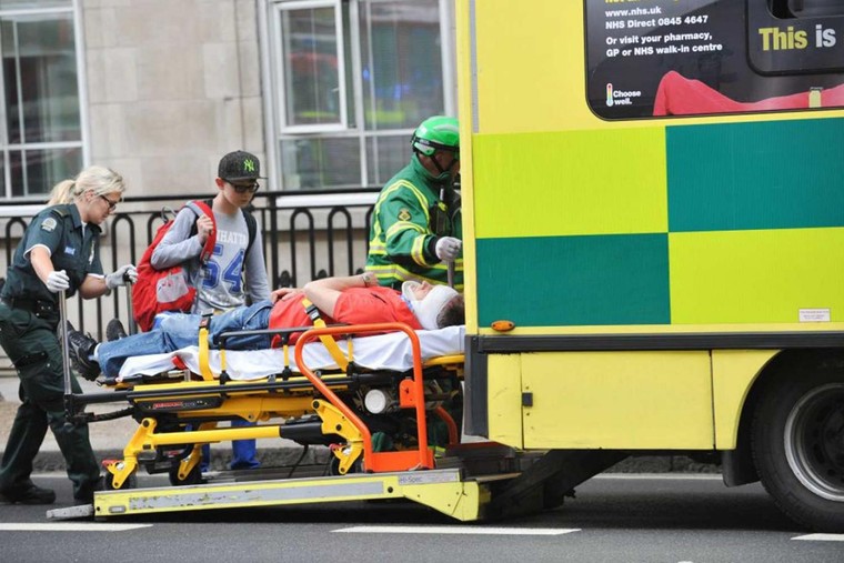 Bị cắt lìa tai vì ngồi xe buýt 2 tầng ở Anh ảnh 1