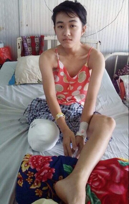 Vụ nữ sinh mất chân vì bác sĩ tắc trách: Bộ Y tế yêu cầu làm rõ ảnh 1