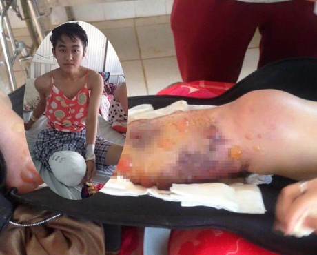 Điểm lại những vụ cắt nhầm, mổ nhầm.... của ngành y ảnh 1